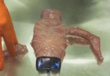 Robot Bio-Hybrid Oscar Revolusi Teknologi Medis 2026