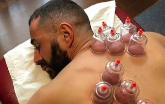 Sehat Ala Rasul: Bekam untuk Tubuh dan Jiwa