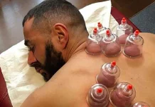 Sehat Ala Rasul: Bekam untuk Tubuh dan Jiwa