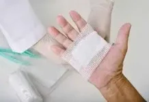 Langkah-Langkah Tepat Merawat Luka Guna Mencegah Risiko Infeksi